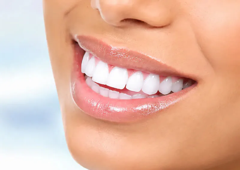 A bright, white smile after professional teeth whitening at Clearbrook Advanced Dental Care in Cranbury, NJ