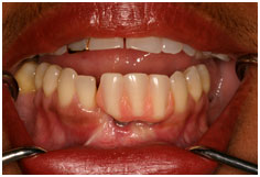 Before - After Dental Work
